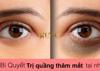trị thâm quầng mắt
