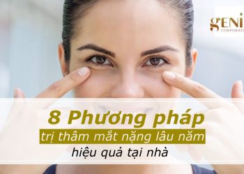 8 Phương pháp trị thâm mắt nặng lâu năm hiệu quả tại nhà