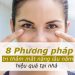 8 Phương pháp trị thâm mắt nặng lâu năm hiệu quả tại nhà