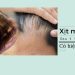 Xịt mọc tóc sau 1 tháng có hiệu quả không ? Loại nào ưa chuộng nhất hiện nay