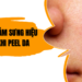 4 cách giảm sưng hiệu quả khi peel da, chị em lưu lại ngay nhé!