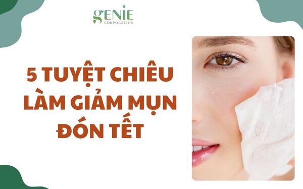 5 tuyệt chiêu làm giảm mụn đón Tết